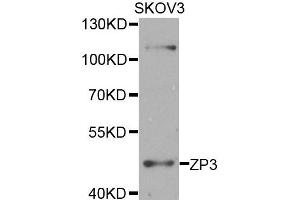 Western blot analysis of extracts of SKOV3 cells, using ZP3 antibody. (Zona Pellucida Glycoprotein 3 antibody)