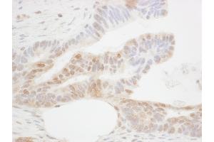 Immunohistochemistry (IHC) image for anti-Caudal Type Homeobox 2 (CDX2) (AA 250-300) antibody (ABIN7454371)
