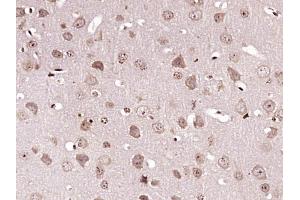 Paraformaldehyde-fixed, paraffin embedded Mouse brain Antigen retrieval by boiling in sodium citrate buffer (pH6. (Caspase 6 antibody  (AA 181-293))