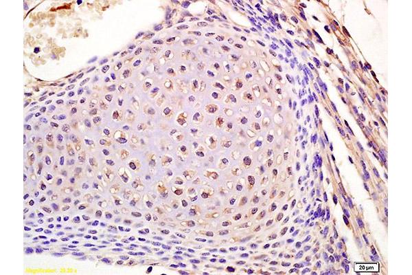 Lamin B Receptor antibody  (AA 1-100)