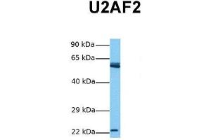 Host:  Rabbit  Target Name:  U2AF2  Sample Tissue:  Human Jurkat  Antibody Dilution:  1.