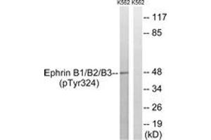 Western blot analysis of extracts from K562 cells treated with serum 20% 15', using Ephrin B1/B2/B3 (Phospho-Tyr324) Antibody. (Ephrin B1/B2/B3 (AA 290-339), (pTyr324) antibody)