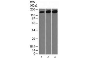 Western blot testing of 1) human HepG2, 2) HeLa and 3) mouse NIH3T3 cell lysate with Topoisomerase II alpha antibody (clone TOP2A/1361).