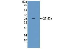 Detection of Recombinant ADAMTS9, Human using Polyclonal Antibody to A Disintegrin And Metalloproteinase With Thrombospondin 9 (ADAMTS9) (ADAMTS9 antibody  (AA 1727-1935))