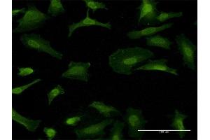 Immunofluorescence of monoclonal antibody to GFRA1 on HeLa cell. (GFRA1 antibody  (AA 32-119))
