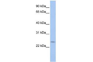 WB Suggested Anti-PRELID2 Antibody Titration: 0. (PRELID2 antibody  (C-Term))