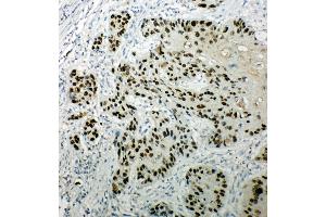 Immunohistochemistry (IHC) image for anti-Tumor Protein P63 (TP63) (AA 664-680), (C-Term) antibody (ABIN3044067)