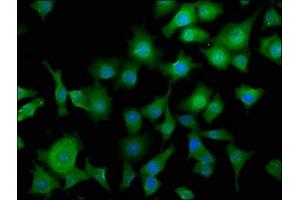 Immunofluorescence staining of SH-SY5Y cells with ABIN7164419 at 1:50, counter-stained with DAPI. (Deltex Homolog 3 antibody  (AA 90-347))