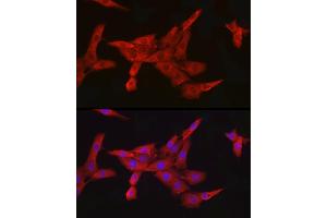 Immunofluorescence (IF) image for anti-Inhibitor of kappa Light Polypeptide Gene Enhancer in B-Cells, Kinase beta (IKBKB) antibody (ABIN7267873)