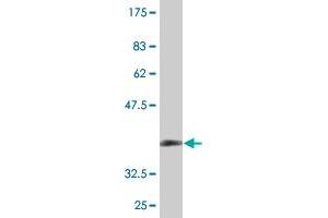 Western Blot detection against Immunogen (36. (ZDHHC13 antibody  (AA 181-280))