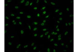 Immunofluorescence staining of Hela Cells with ABIN7127523 at 1:50, counter-stained with DAPI. (Recombinant GZMB antibody)