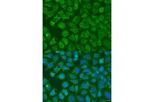 Immunofluorescence analysis of U2OS cells using EIF2B1 antibody (ABIN6132115, ABIN6140035, ABIN6140036 and ABIN6223878) at dilution of 1:100. (EIF2B1 antibody  (AA 1-305))