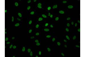 Immunofluorescence staining of Hela Cells with ABIN7127334 at 1:50, counter-stained with DAPI. (Recombinant ALDOA antibody)