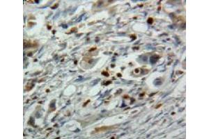#VALUE! (EBI3 antibody  (AA 21-229))