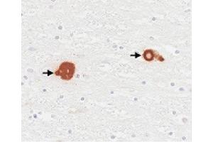 Paraffin embedded human brain tissue from Parkinson’s disease patients was stained with anti-α-synuclein followed by Goat Anti-Mouse IgA-BIOT:. (Goat anti-Mouse IgA (Heavy Chain) Antibody (Biotin))