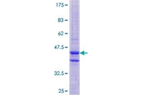 PNCK Protein (AA 1-121) (GST tag)