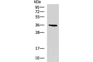 Western blot analysis of A549 cell lysate using BDNF Polyclonal Antibody at dilution of 1:900 (BDNF antibody)