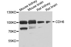 Western blot analysis of extracts of various cell lines, using CDH6 antibody (ABIN5974784) at 1/1000 dilution.