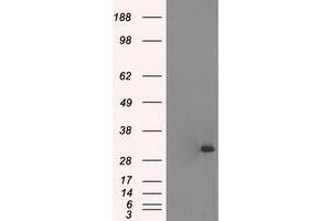 Western Blotting (WB) image for anti-Cardiac Troponin I (TNNI3) (AA 1-210) antibody (ABIN1490609)