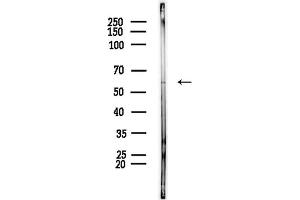 anti-PRP4 Pre-mRNA Processing Factor 4 Homolog (PRPF4) (Internal Region) antibody