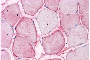 Human Skeletal Muscle: Formalin-Fixed, Paraffin-Embedded (FFPE) (SEMA4B antibody  (Internal Region))