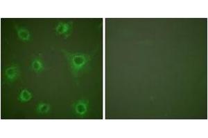 Immunofluorescence analysis of COS7 cells, using Collagen II Antibody. (COL2 antibody  (AA 101-150))