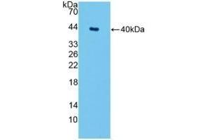 Detection of Recombinant SPTLC1, Mouse using Polyclonal Antibody to Serine Palmitoyltransferase, Long Chain Base Subunit 1 (SPTLC1) (SPTLC1 antibody  (AA 143-473))