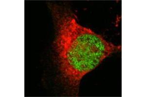 Confocal immunofluorescence analysis of Eca 109 cells using MOF/MYST1 mouse mAb (green), showing nuclear localization. (MYST1 antibody)