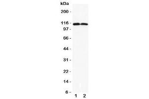 Western blot testing of DOG1 antibody and Lane 1:  rat liver (ANO1 antibody  (C-Term))