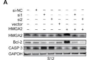 Expression of HMGA2 and its related genes in S12, SiHa, and CaSki cellsWestern blot analysis of HMGA2, Bcl-2, and Caspase 3 protein expression in S12 (A), SiHa (B), and CaSki (C) cells and control cells after treatment with HMGA2 overexpression plasmid or siRNAs. (Caspase 3 antibody  (AA 55-160))
