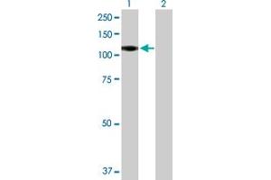 Western Blot analysis of CSF3R expression in transfected 293T cell line by CSF3R MaxPab polyclonal antibody. (CSF3R antibody  (AA 1-836))