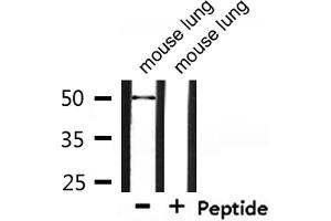 Retinoic Acid Receptor beta antibody  (Internal Region)