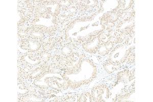 Immunohistochemistry (IHC) image for anti-Myb-Binding Protein 1A (MYBBP1A) (AA 450-500) antibody (ABIN7454398)