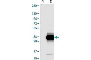 Western blot analysis of Lane 1: Negative control (vector only transfected HEK293T lysate). (ZCCHC10 antibody)