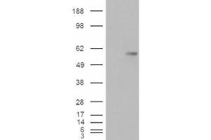 Western Blotting (WB) image for anti-V-Set Domain Containing T Cell Activation Inhibitor 1 (VTCN1) (Internal Region) antibody (ABIN2466446) (VTCN1 antibody  (Internal Region))