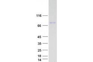 Western Blotting (WB) image for Rhophilin, rho GTPase Binding Protein 1 (RHPN1) protein (Myc-DYKDDDDK Tag) (ABIN2730878)