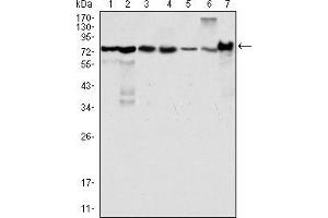 Western blot analysis using LPP mouse mAb against Hela (1), NIH/3T3 (2), COS (3), Caki (4), MCF-7 (5), HepG2 (6) and SMMC-7721 (7) cell lysate. (LPP antibody)