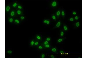 Immunofluorescence of monoclonal antibody to HDAC1 on HeLa cell. (HDAC1 antibody  (AA 1-482))