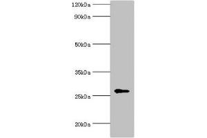 Western blot All lanes: N-alpha-acetyltransferase 10 antibody at 5 μg/mL + Hela whole cell lysate Secondary Goat polyclonal to rabbit IgG at 1/10000 dilution Predicted band size: 27, 25 kDa Observed band size: 27 kDa (PTPDC1 antibody  (AA 161-235))
