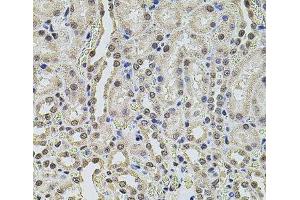 Immunohistochemistry of paraffin-embedded Rat kidney using SMARCC2 Polyclonal Antibody at dilution of 1:100 (40x lens).