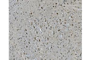 IHC analysis of LSM7 using anti-LSM7 antibody (ABIN7598937). (LSM7 antibody  (AA 1-103))