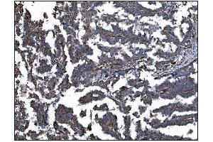 IHC analysis of CD39/ENTPD1 using anti-CD39/ENTPD1 antibody (ABIN7602461). (CD39 antibody  (AA 79-411))