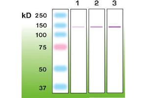 Western Blotting (WB) image for anti-Nephrosis 1, Congenital, Finnish Type (Nephrin) (NPHS1) (AA 53-101), (C-Term) antibody (ABIN870341) (Nephrin antibody  (C-Term))