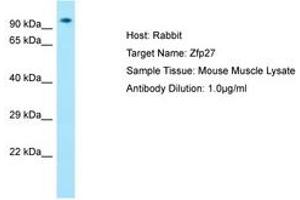Zinc Finger Protein 27 (ZFP27) (AA 651-700) Antikörper