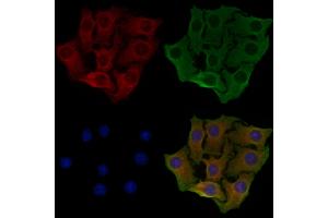 ABIN6257929 and ABIN6274818 staining Hela cells by IF/ICC. (ARFGAP1 antibody  (Internal Region))