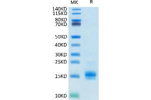 Biotinylated Human MCP-1 on Tris-Bis PAGE under reduced condition. (CCL2 Protein (His-Avi Tag,Biotin))