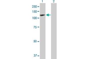 Western Blot analysis of HIP1 expression in transfected 293T cell line by HIP1 MaxPab polyclonal antibody. (HIP1 antibody  (AA 1-1037))