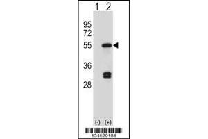 Western blot analysis of FDFT1 using rabbit polyclonal FDFT1 Antibody using 293 cell lysates (2 ug/lane) either nontransfected (Lane 1) or transiently transfected (Lane 2) with the FDFT1 gene.
