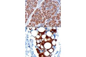 Image no. 2 for anti-Pancreatic and Duodenal Homeobox 1 (PDX1) (C-Term) antibody (ABIN374551) (PDX1 antibody  (C-Term))