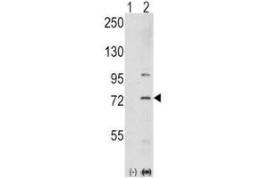 Western blot analysis of PAK1 antibody and 293 cell lysate either nontransfected (Lane 1) or transiently transfected with the PAK1 gene (2). (PAK1 antibody  (AA 401-430))